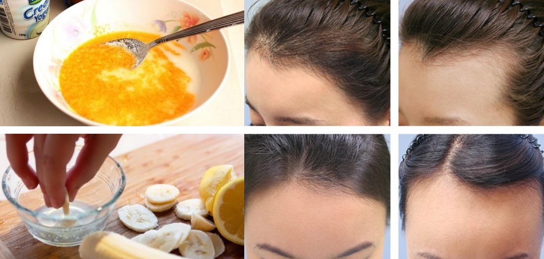Tóc bạn sẽ “mọc như nấm sau mưa” với hỗn hợp ngâm tóc này!