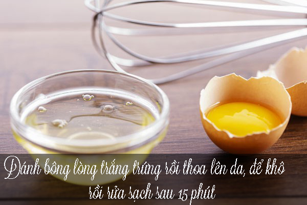 5 mẹo chữa bỏng nắng vừa nhanh vừa hiệu quả