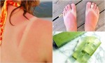 Du lịch về, đắp mặt nạ này để biến làn da cháy nắng thành trắng hồng