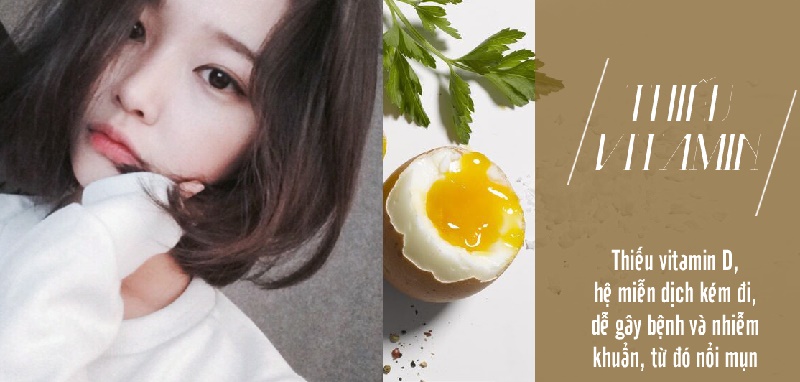 Mặt sẽ xinh hơn nếu bạn chịu khó thay đổi 8 thói quen sau