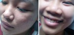 Da sáng trắng bất ngờ sau 7 ngày chỉ với mặt nạ cà chua "thần thánh"
