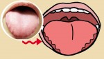HÃY CẨN THẬN: Nếu nhìn thấy rìa lưỡi có hình răng cưa như thế này