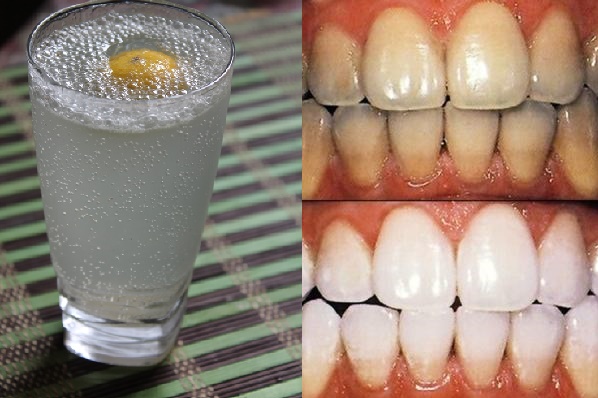 Ngậm thứ nước này 2 phút mỗi ngày, răng ố vàng cũng chuyển thành trắng sáng một cách khó tin