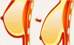 Làm 1 tuần/lần: vòng 1 chảy xệ cũng săn chắc như gái đôi mươi
