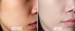 Cách giúp da sáng đẹp nhanh chóng dù đen tới đâu mà không tốn kém