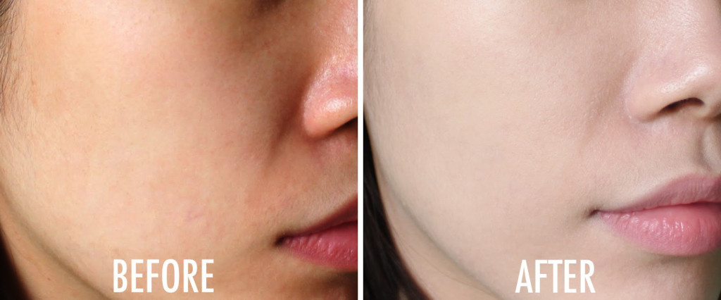 Cách giúp da sáng đẹp nhanh chóng dù đen tới đâu mà không tốn kém