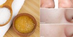 4 mặt nạ thu nhỏ lỗ chân lông to tốt hơn cả nước hoa hồng