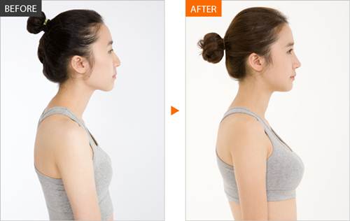 Vòng 1 tăng size “nhanh chóng mặt” chỉ từ hỗn hợp vài chục nghìn này