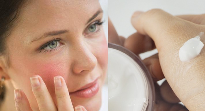 7 điều bạn nhất định phải biết về da nhạy cảm