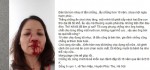 Dân mạng phẫn nộ cảnh chồng đánh vợ như kẻ thù