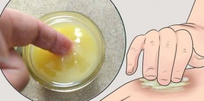 Da bị cháy nắng, hãy vào bếp tìm ngay những nguyên liệu này