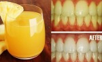 Ngậm thứ này 3 phút rồi nhổ, răng trắng bóng khó tin không cần tốn 1 xu đi nha sỹ
