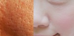 Xử lý tận gốc lỗ chân lông to, không lo tốn kém chỉ trong 2 bước!