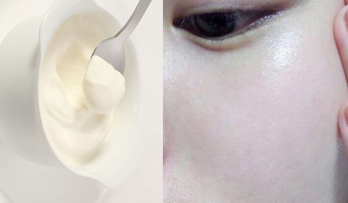 Mụn đầu đen nhiều đến đâu cũng hết sạch nhờ dùng sữa chua đúng cách
