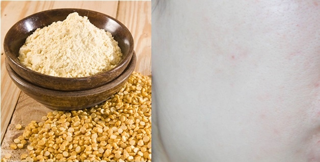 Da sạch mụn, hết nhờn và trắng xứ với bột đậu gà