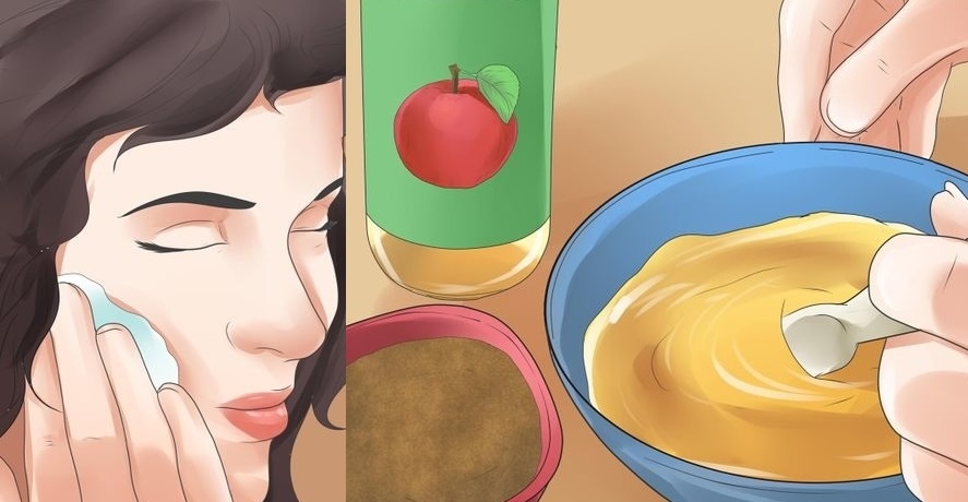 Những biện pháp "xử lý" mụn đầu đen nhanh chóng và hiệu quả nhất