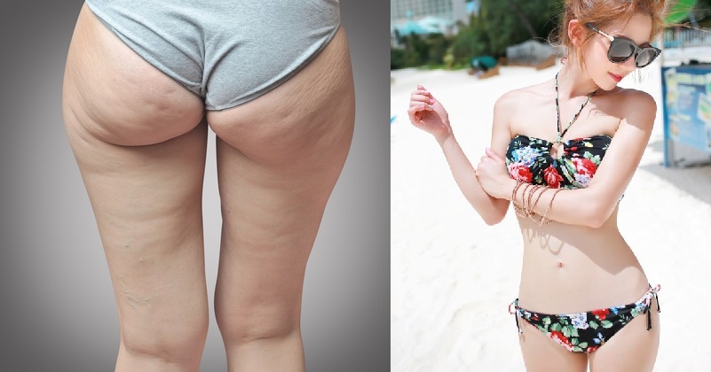 Ăn uống theo cách này, giảm 3kg/10 ngày và hết sần vỏ cam