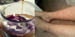 Tìm ra “thần dược” đánh bay các vết sẹo thâm lâu năm cực kỳ hiệu quả