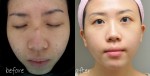 Chia sẻ bí quyết dưỡng trắng da trị mụn (đã được mình chuột bạch thành công sáng rỡ)