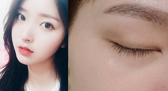 Cách ‘gột sạch’ các loại mụn giúp làm trắng da chỉ với một loại vỏ mà ai cũng vứt bỏ