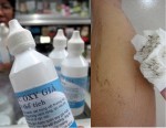 Lông tay, chân và nách tự rụng không còn 1 cọng chỉ bằng 1 lọ oxy già, ai cũng nên thử ngay