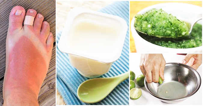 Bôi hỗn hợp đơn giản này lên, da sạm đen, cháy nắng bỗng trắng hồng trở lại