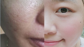 Để tuổi 30 tuổi làn da vẫn căng mịn như gái 18