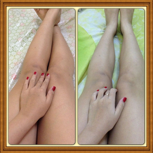 Massage với hỗn hợp này 5 phút mỗi ngày, da trắng bóc không cần bôi kem sau 1 tuần
