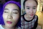 Chia sẻ kinh nghiệm trị mụn, khôi phục da mụn và da tổn thương bằng bột yến mạch