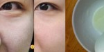 Kinh nghiệm trị thành công lỗ chân lông to cho làn da có mụn đầu đen