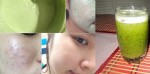Mụn hết sạch, da trắng bóc chỉ sau 10 ngày uống ly sinh tố này