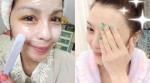 Top 4 sản phẩm trị mụn vừa tốt, vừa an toàn được các bác sĩ khuyên dùng