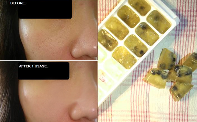Dưỡng da căng mịn, không lo nổi mụn chưa đến 5k, bạn nên thử ngay