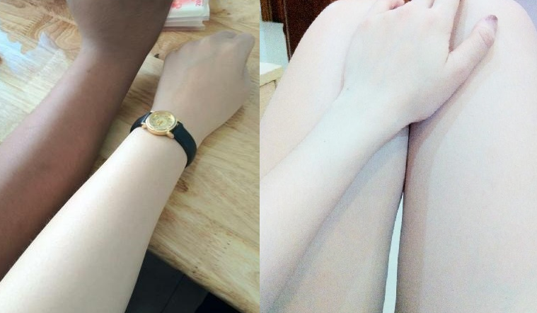 Công thức "lột da đen" nhanh trắng mà an toàn, giúp bạn gái tự tin mặc đẹp hơn