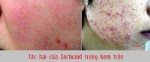 Bằng chứng cho thấy tác hại của kem chứa Corticoid là thật