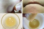 Trộn 3 thứ này với nhau rồi thoa lên mũi, "diệt tiệt" mụn cám mà không cần nặn