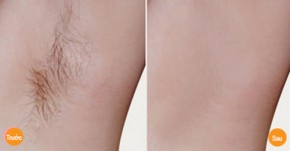 Hỗn hợp giúp vùng da dưới cánh tay vừa trắng lại thơm tho