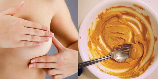 Làm hồng nhũ hoa không cần phun xăm sau 1 tuần