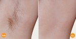 Bí quyết "dọn cỏ" vùng da dưới cánh tay vừa sạch, vừa trắng lại thơm tho