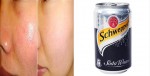 Cách làm se khít lỗ chân lông chỉ với 1 lon Soda 10k