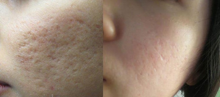 3 bước chăm sóc da mặt từ nguyên liệu tự nhiên giúp giảm thâm, trắng da như đi spa