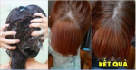 5 cách kích thích tóc nhanh SIÊU CẤP gấp 3 lần so với bình thường