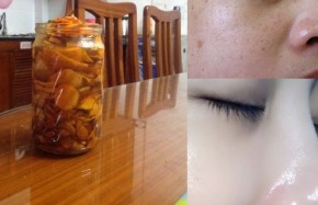 Nhờ siêng làm 1 hũ này và kiên trì dùng, sau 2 tuần mà da mình đã trắng mịn như da em bé
