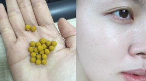 Trong uống viên nghệ, ngoài thoa nghệ mật ong - da hết mụn và trắng hồng