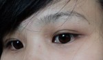 Tin vui cho chị em bị mụn thịt - 5 mẹo đơn giản giúp bạn đánh bay mụn thịt dễ dàng