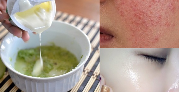 3 loại mặt nạ CỨ ĐẮP LÀ TRẮNG, da hết thâm nám và giảm mụn rõ rệt