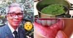 Bài thuốc quý chữa khỏi nhiệt miệng chỉ sau 1 đêm của Giáo sư Tất Lợi