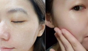 TOP 3 sản phẩm trị nám hiệu quả, được chị em sử dụng và chia sẻ nhiều