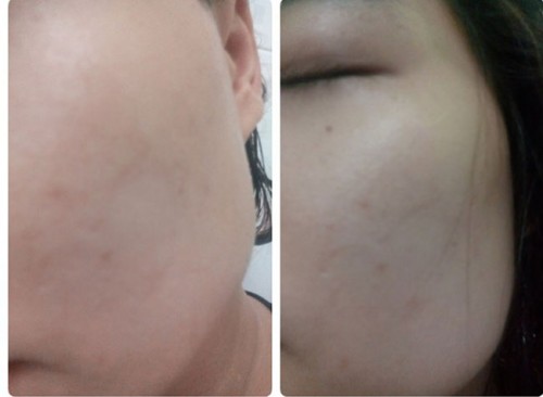 Da tôi trắng mịn hoàn toàn chỉ mất 1 tiếng/tuần thôi