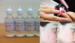 Bất ngờ với những công dụng làm đẹp chỉ bằng 1 chai cồn y tế, bạn cần biết ngay